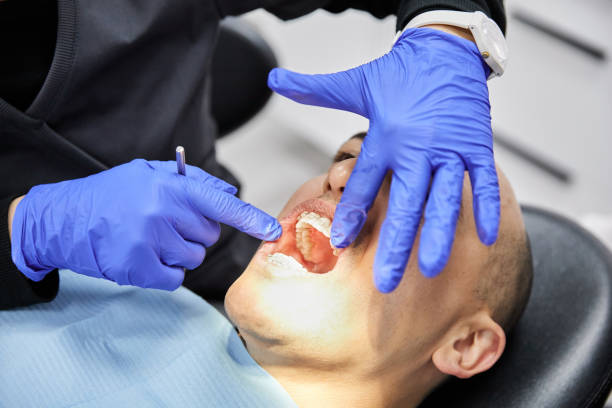 Best Emergency Dentist for Knocked-Out Tooth in Reed Creek, GA
